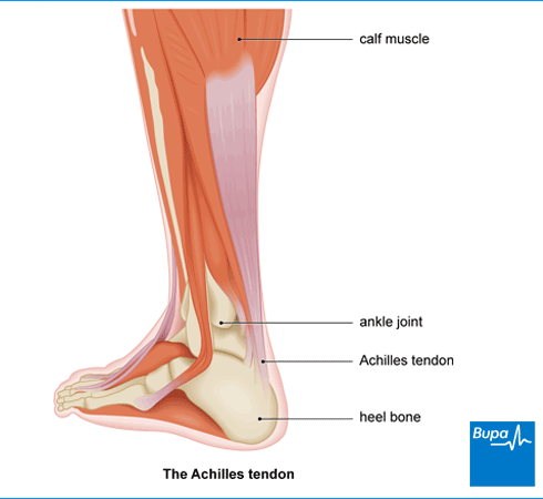 achilles tendon heel tendinopathy rupture pain muscles bones around when between health bupa treatment symptoms behind causes exercise move running