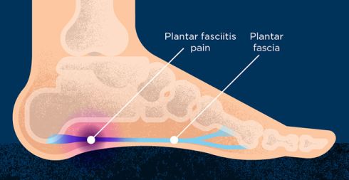 foot pain above heel below ankle