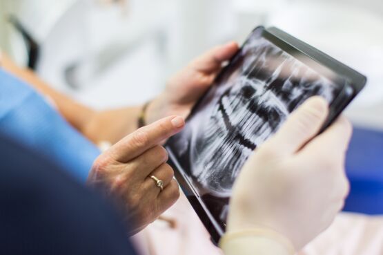 Dentist looks at scan