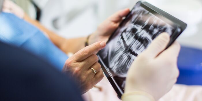 Dentist looks at scan