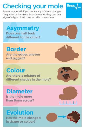 Mole Check Checklist How to check your moles for signs of skin cancer