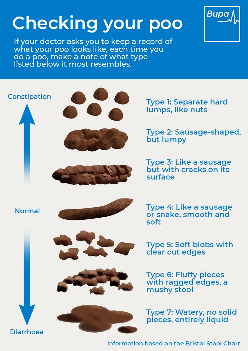 Irritable bowel syndrome (IBS): Symptoms and causes | Bupa UK