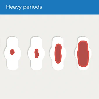 infographic showing first symptom of endometriosis: Painful or heavy periods