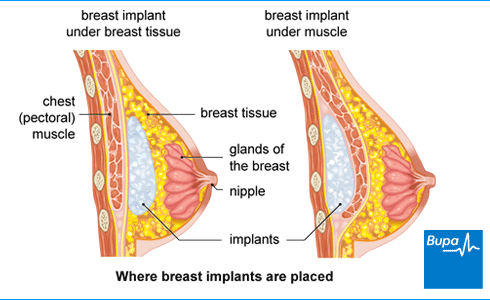 Natural Way To Make Ur Breast Bigger Natural Way To Make Ur Breast Bigger