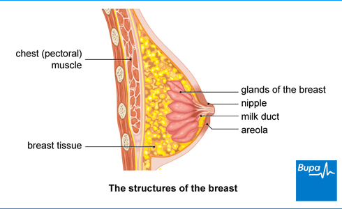 Breast Lumps: Clogged Milk Duct or Cancer?