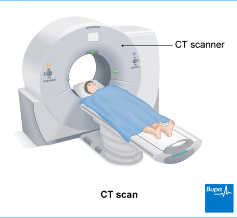 CT scan Information Bupa UK