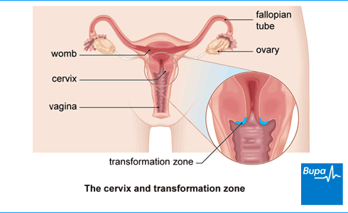 Image showing the cervix and transformation zone