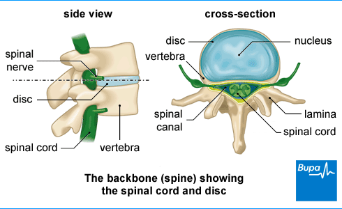 Lumbar Spinal Stenosis  Diagnosis & Treatment for Physios