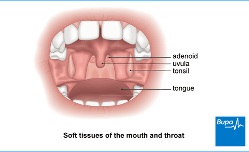 An image showing the soft tissues of the mouth and throat