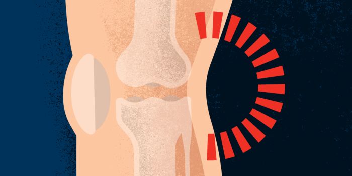 That Pain in Your Knees and Lower Back Could Be Linked to Your