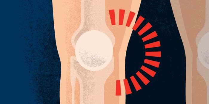 Inner (medial) knee pain, Health Information