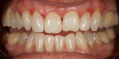 Before and Afters | Malt House Specialist Dental Centre