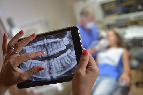World Oral Health Day - X ray image