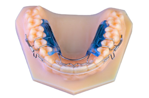  Inman Aligners on an orthodontic mode
