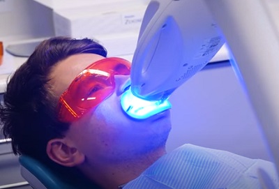 Patient with blue light in mouth having teeth whitening at Bupa Dental Care.
