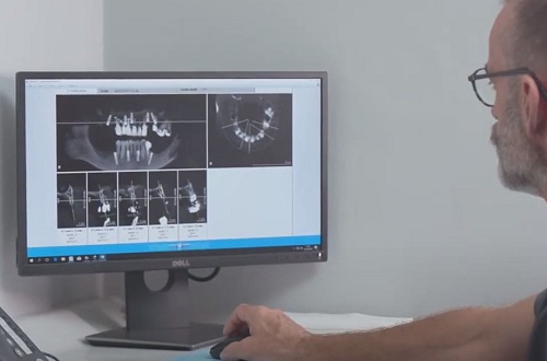 Peter Sanders looking at patient X-rays at Dental Confidence Southampton
