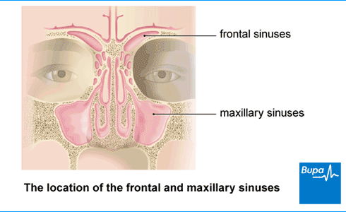 An image showing the location of the frontal and maxillary sinuses